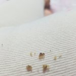 [댓글부탁해] 피어싱 왕<b>고름</b> 나옴