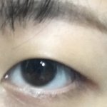 [댓글부탁해] <b>쌍</b><b>테</b>하면 나아질까ㅠㅜㅠ???
