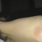 [조언부탁해] 제발 코 마사지 하는법좀