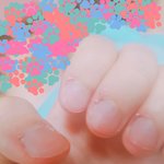 약간혐)<b>손톱</b>옆에 살?안뜯는방법좀ㅠㅠ