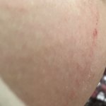 이거 <b>땀띠</b>야?