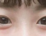 [댓글부탁해] 내 눈 몽고<b>주름</b> 있는눈이야?쌍꺼풀 무슨라인인지봐줘...