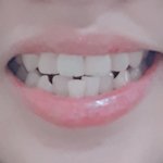 교정하는애들 다 드루와줘 ㄱㄱ