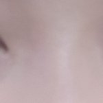 [조언부탁해] 웃을때 <b>눈밑</b>에 왜이러는거야,,??ㅠㅜ