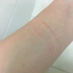 [댓글부탁해] 이거 <b>자해</b>한것처럼 보여??