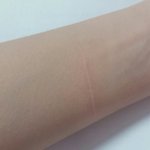 나 자해? 했는데 부어<b>오름</b>