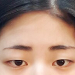 +)추가 나 <b>쌍수</b> 대성공함