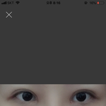 앞트임 <b>복원</b> 해본 친구 있어?