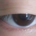 [댓글부탁해] 나 안검<b>하수</b> 개심한데 쌍수하면(혐주의)