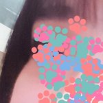 <b>볼살</b> 어떻게 뺌 진짜심각해