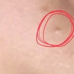 [댓글부탁해] 약혐)이 트러블이 뭔지 아는 사람ㅠㅠ