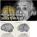 [명랑엽떡] 토막낸 아인슈타인의 <b>두뇌</b>