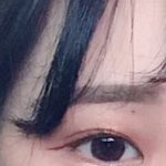 쌍수 7개월 됐는데 어때