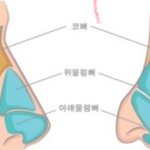 [댓글부탁해] <b>하이코</b> 제거하고 코수술받았는데요..