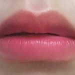 입술<b>필러</b> 맞을까 고민중인데