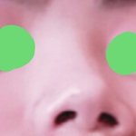 민디 코 낮아지고 커지는 과정 다들 바 조랏