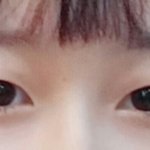 [ㅈㄱㄴ] 얘들아 나 <b>쌍수</b> 엄청 잘됐다!!!ㅎㅎㅎ