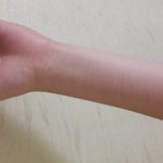 [댓글부탁해] <b>자해</b> 흉터