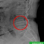 [19] ㅇㅉ <b>아파</b>,,