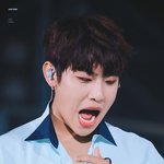 [박우진] <b>아랫니</b> 가지런히 옹기종기 (ㅜㅜ)