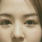 나<b>눈코</b>수술한거어때
