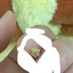 이게 <b>편도</b>결석이야? 약혐..