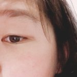 [드루와] 얘들아 나 여드름 톡선 올라갔던 쓰니야! '◇'