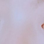 [댓글부탁해] <b>쌍수</b>ㅜㅜㅜ봐주라ㅜㅜ
