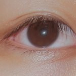 [댓글부탁해] 몽고<b>주름</b> 심한 눈이야??
