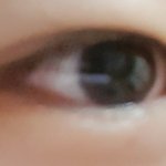 [사진ㅇ] 나 같이 <b>색소</b>침착된 애 있냐