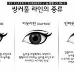 [댓글부탁해] 나 <b>선도</b>갈거같은데 많이 안좋음?