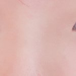 [조언부탁해] 나 쌍수할건데 봐주랑