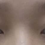 나도 쌍수잘됨ㅋㅋㅋㅋ