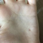 손에 <b>구멍</b> 났어 뭐지?? 도와줘