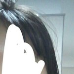 나 <b>안면</b>비대칭 조카 심각한데 어떡하냐