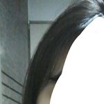 나 <b>안면</b>비대칭 조카 심각쓰