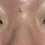 [조언부탁해] 나 코가 너무 스트레스야..