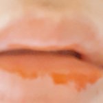 [댓글부탁해] 입술각질이 계속 생겨 (<b>사진o</b>)