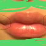 [조언부탁해] 입술 주변 빨개지는거 왜이래...?;;;;
