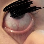 야야 나 눈 조카 <b>충혈</b>됬는데 혐주의