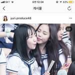 조유리 코 뭐한거지 수술?<b>필러</b>?