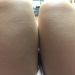 [조언부탁해] 내 다리에 이상한거 났어(약혐주의)