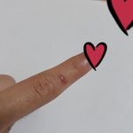 친구가 내 손에 <b>글루</b>건 떨어트렸는데