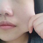 [댓글부탁해] 20<b>대초</b>인데 피부노화가 벌써왔어요ㅜㅜ