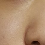 [약간혐] 피부에 검은점같은거 뭐임,,,?