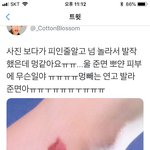 [EXO] <b>피멍</b>이 이렇게 들수있냐ㅜㅜㅜ