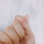 [드루와] 사진) 우리집 뚱때지 도치한테 물림 큐ㅠㅠㅠㅠ