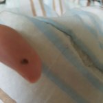 [댓글부탁해] 피어싱 왕<b>고름</b> 발굴