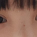 [댓글부탁해] 쌍커풀<b>시름</b>