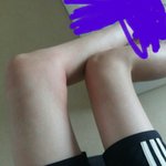 [드루와] 나 모기물린거 개오짐